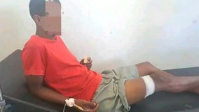    Pemuda Timor Leste Ditembak Gerombolan Bersenjata di Perbatasan Indonesia-Timor Leste