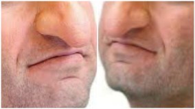 Studi Menunjukkan Ukuran Hidung Berkorelasi dengan Ukuran Alat Vital Pria