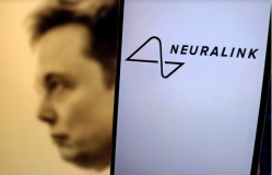 Bukan Fiksi, Elon Musk Memasukkan Chip ke Otak Manusia