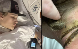 Remaja Hampir Meninggal Setelah Kalung Tersengat Listrik Charger di Lehernya