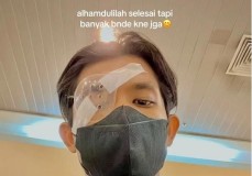 Pemuda Malaysia Jalani Transplantasi Kornea Akibat Mengucek Mata Berlebihan